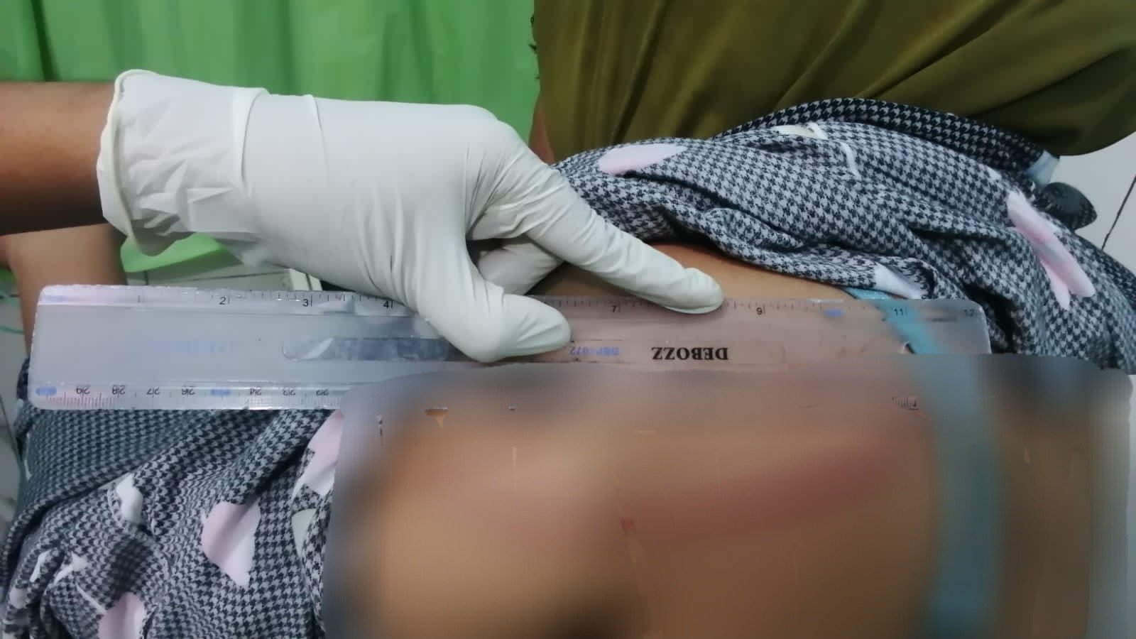 Istri Cekcok, Guru SD Tebas Dua Tetangganya